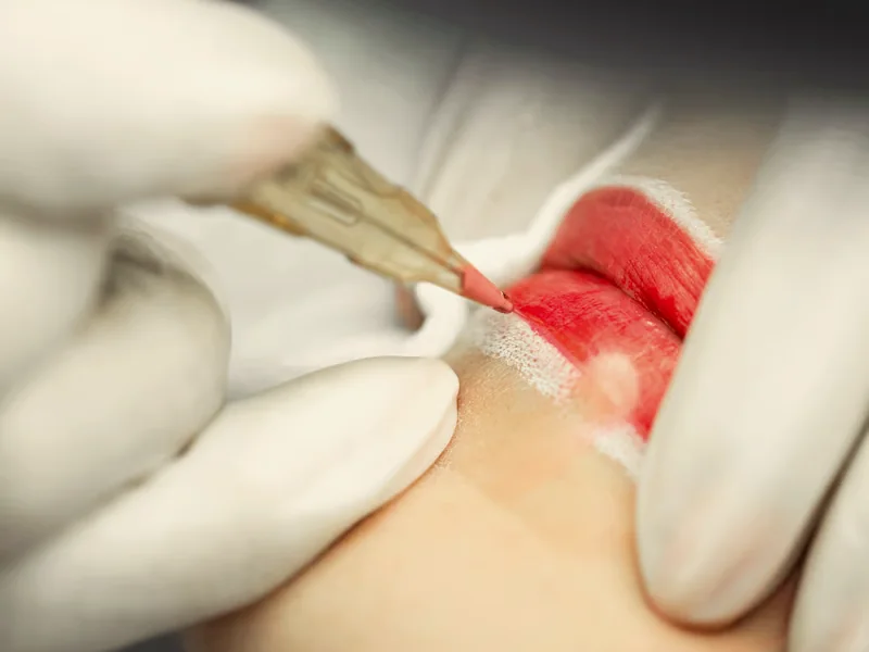 Lip blush colour being placed with a fine needle